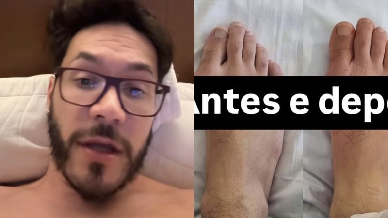 Eliezer posta antes e depois de cirurgia no pé, e web reage: ‘Satisfatório ou nojento?’