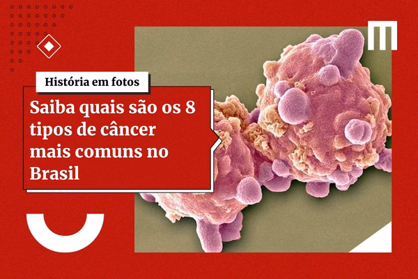 Novo teste genético prevê resistência do câncer à quimioterapia
