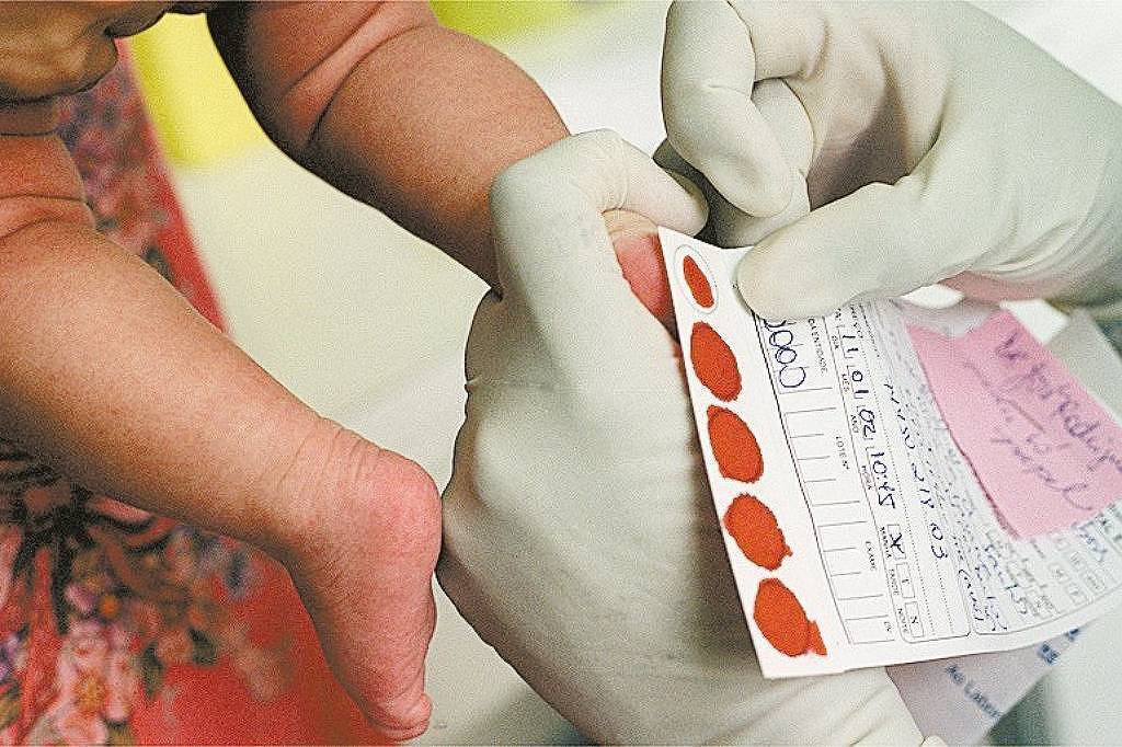 Brasil mapeia suas doenças raras – 27/06/2025 – Equilíbrio e Saúde