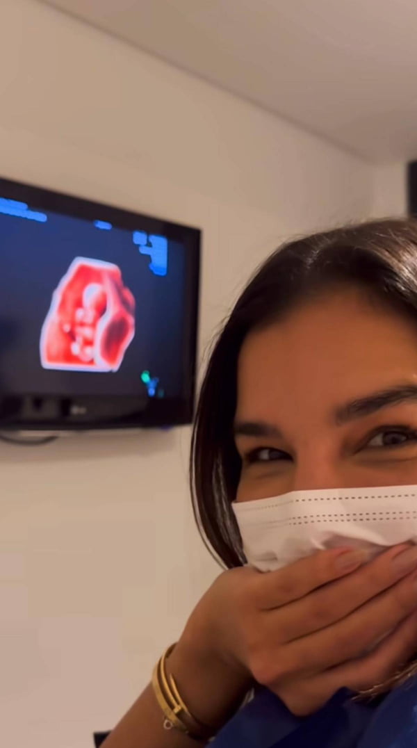 Mariana Rios mostra ultrassom do 1º filho e emociona seguidores