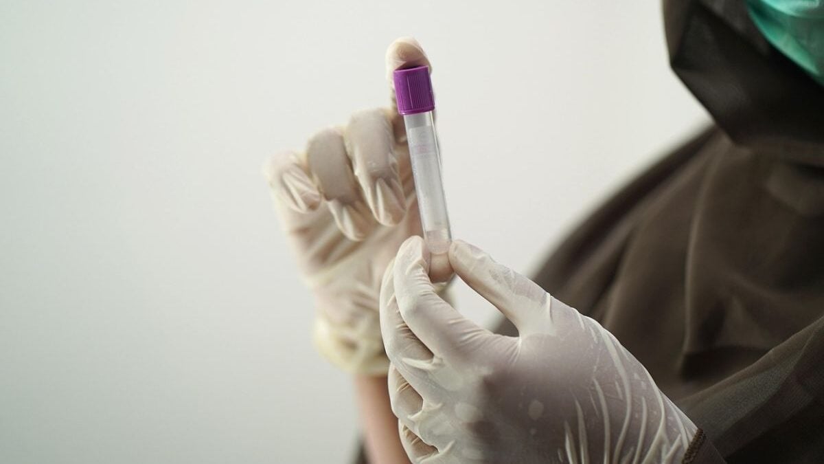 Veja quais tipos sanguíneos têm mais chance de AVC