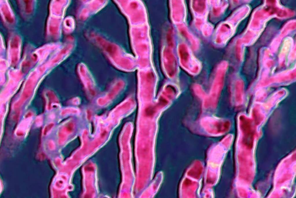 A imagem mostra uma estrutura microscópica de corais, com formas ramificadas e cores predominantes em tons de rosa e roxo. O fundo é escuro, destacando as formas e texturas dos corais.