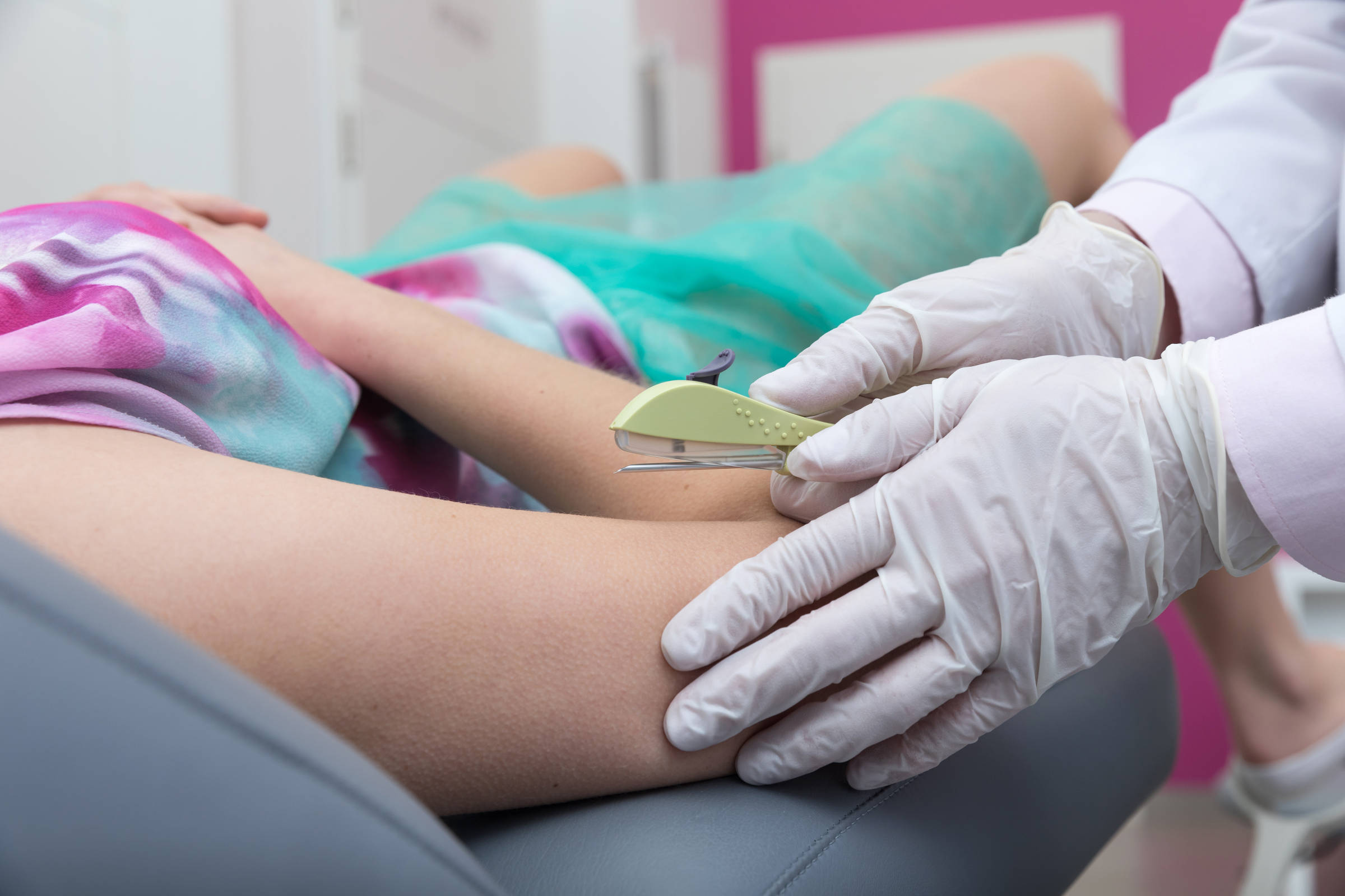 Implanon no SUS: como funciona o implante contraceptivo – 04/07/2025 – Equilíbrio e Saúde
