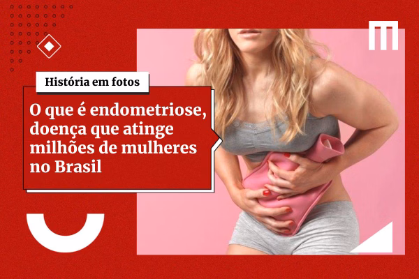 SUS passa a oferecer dois novos tratamentos para endometriose