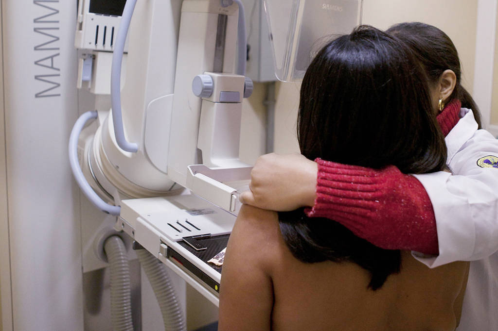 Senado antecipa idade mínima para mamografia no SUS – 09/07/2025 – Equilíbrio e Saúde