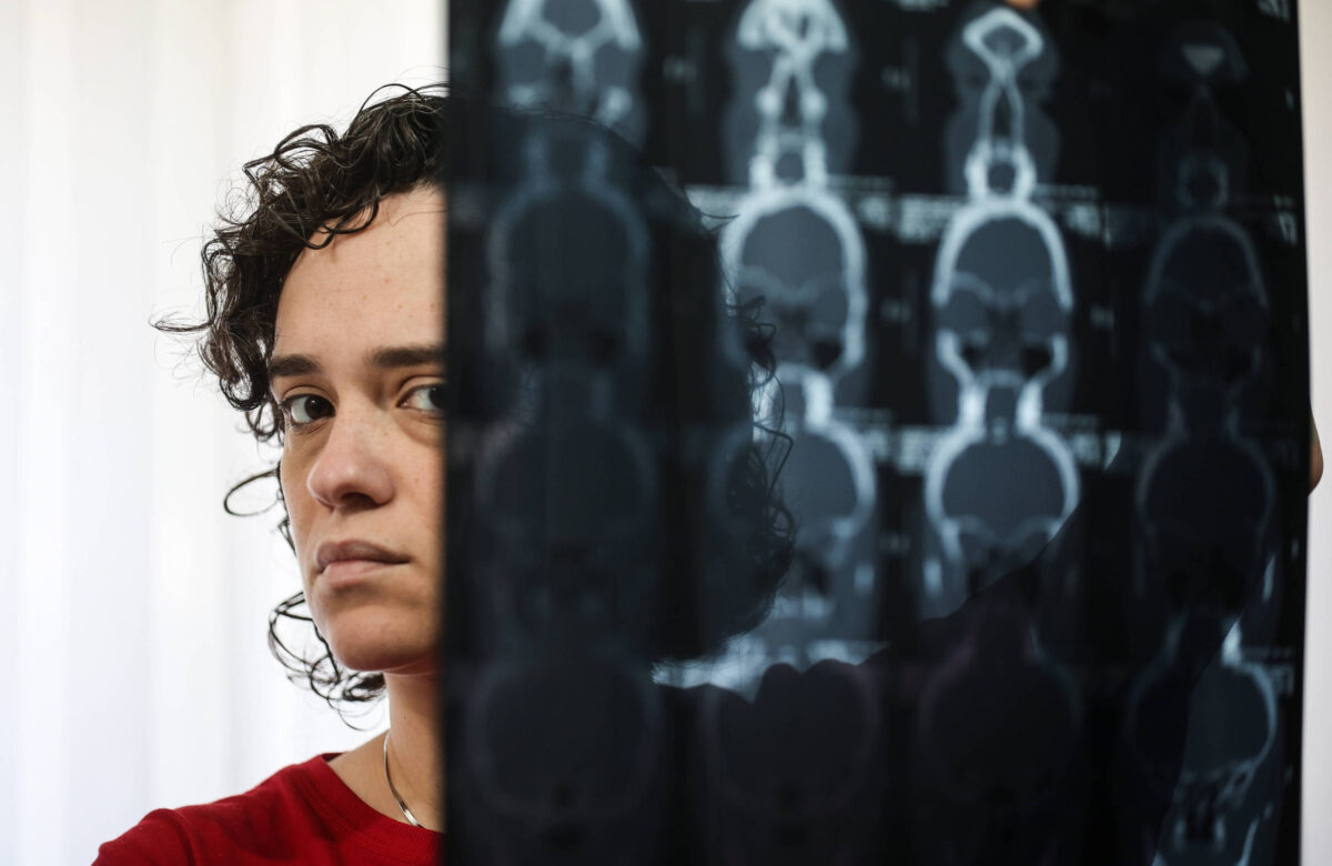 Uma mulher com cabelo cacheado e escuro está segurando uma radiografia em frente ao rosto. Ela tem uma expressão séria e está vestindo uma camiseta vermelha. Ao fundo, há uma cortina clara que deixa passar a luz.